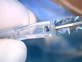 人工晶体植入术：为眼睛装上“高清镜头”的现代黑科技